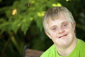 Developmental disabilities - Down syndrome